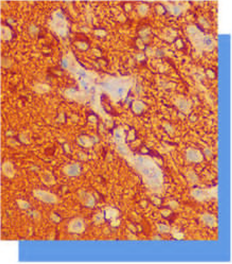 膠質纖維酸性蛋白（Glial Fibrillary Acidic Protein，GFAP）抗體試劑